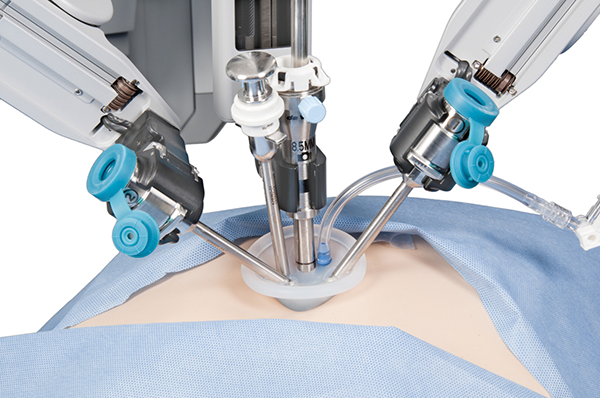Robotic Surgery Encino
